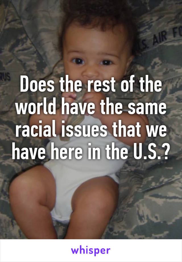 Does the rest of the world have the same racial issues that we have here in the U.S.? 