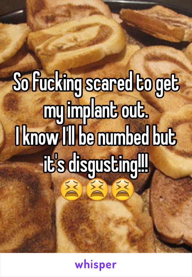 So fucking scared to get my implant out.
I know I'll be numbed but it's disgusting!!!
😫😫😫