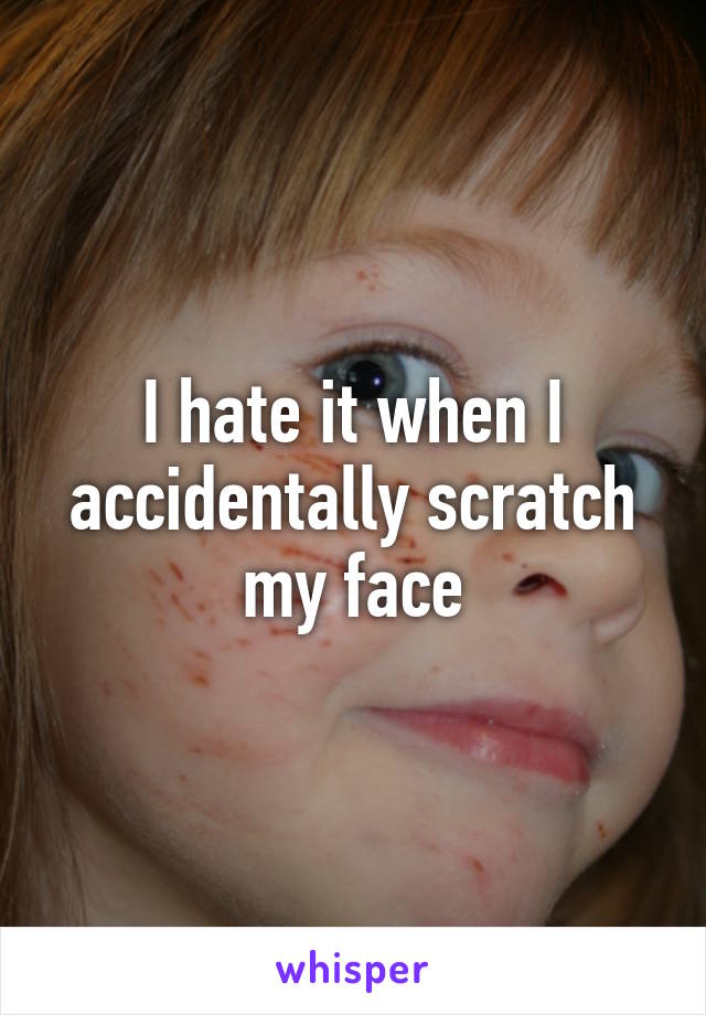 I hate it when I accidentally scratch my face