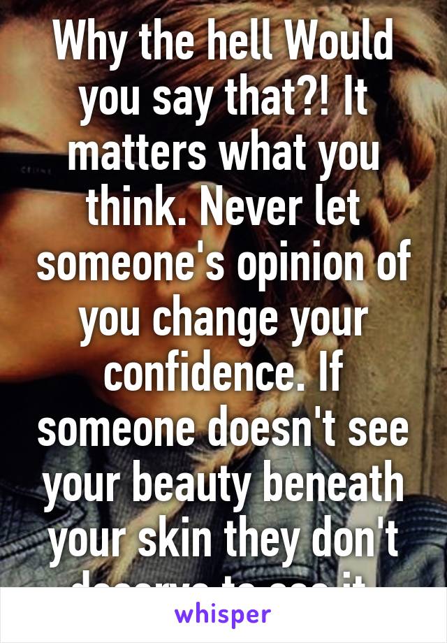 Why the hell Would you say that?! It matters what you think. Never let someone's opinion of you change your confidence. If someone doesn't see your beauty beneath your skin they don't deserve to see it.