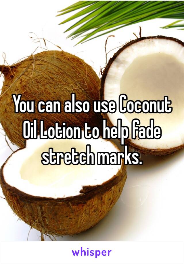 You can also use Coconut Oil Lotion to help fade stretch marks.