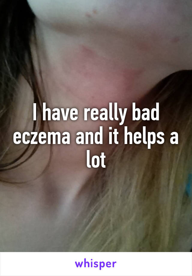 I have really bad eczema and it helps a lot