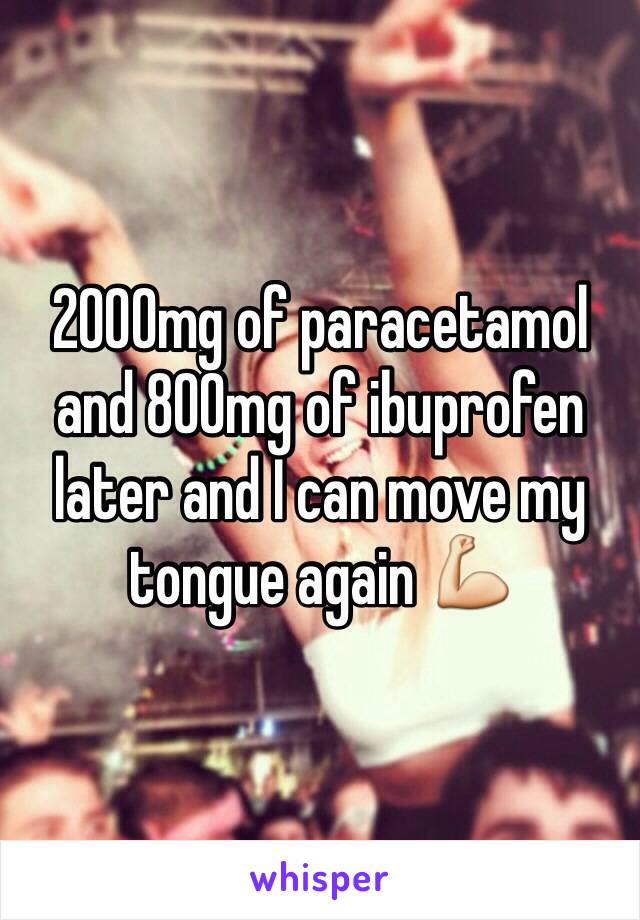 2000mg of paracetamol and 800mg of ibuprofen later and I can move my tongue again 💪