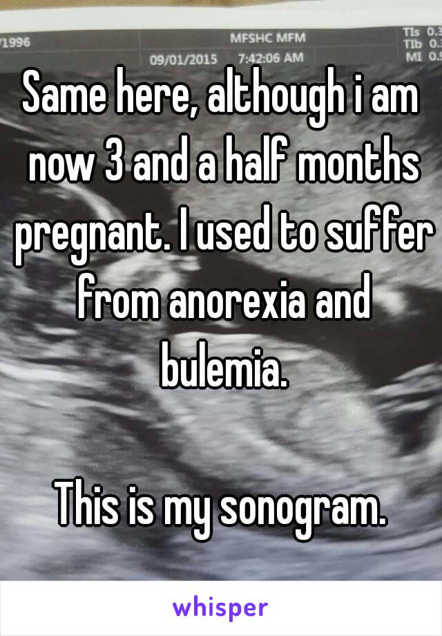 Same here, although i am now 3 and a half months pregnant. I used to suffer from anorexia and bulemia.

This is my sonogram.