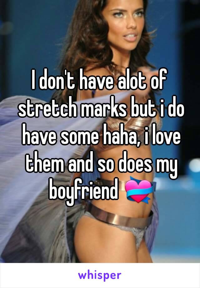 I don't have alot of stretch marks but i do have some haha, i love them and so does my boyfriend 💝