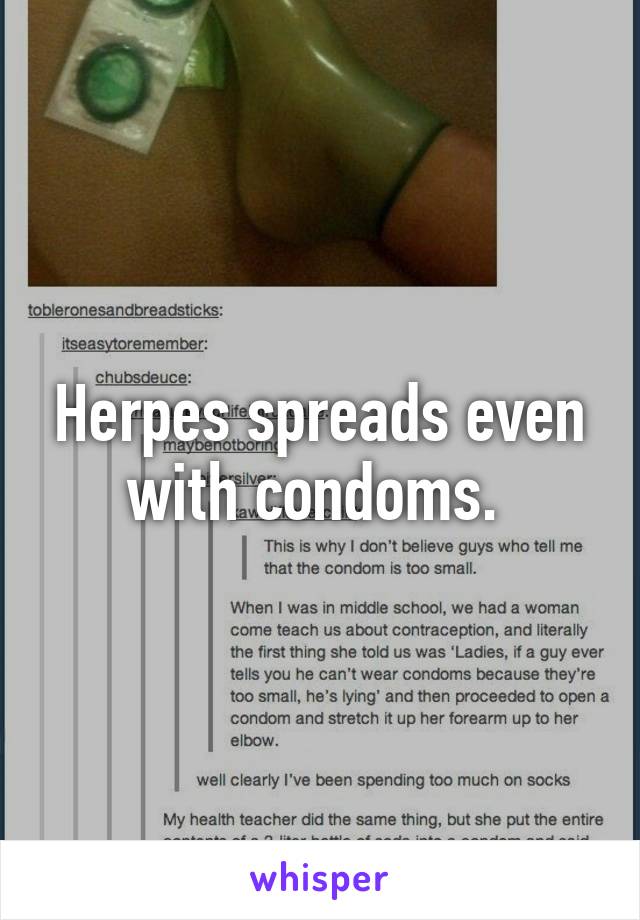 Herpes spreads even with condoms. 