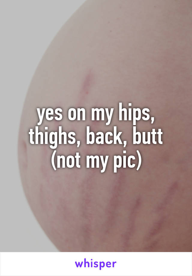 yes on my hips, thighs, back, butt (not my pic)