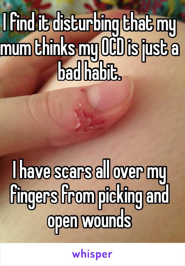 I find it disturbing that my mum thinks my OCD is just a bad habit.



I have scars all over my fingers from picking and open wounds