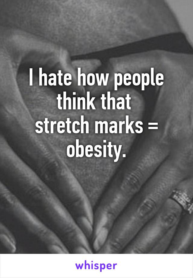 I hate how people think that 
stretch marks = obesity.

