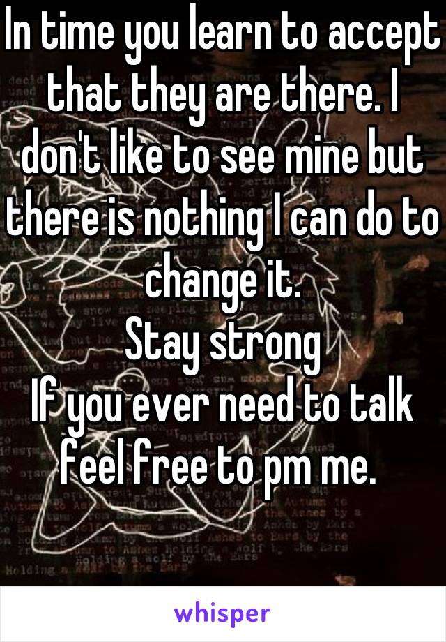 In time you learn to accept that they are there. I don't like to see mine but there is nothing I can do to change it. 
Stay strong
If you ever need to talk feel free to pm me. 