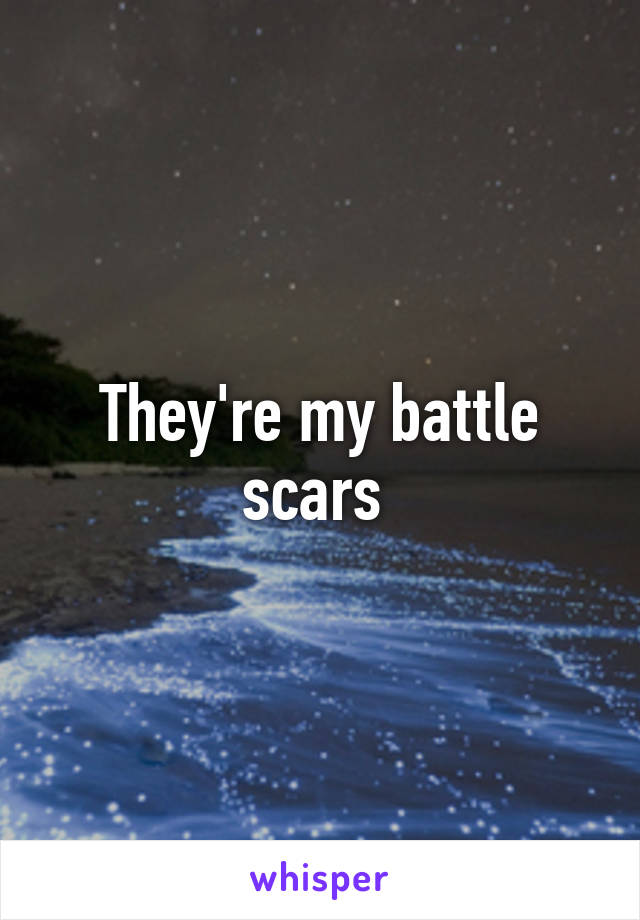 They're my battle scars 