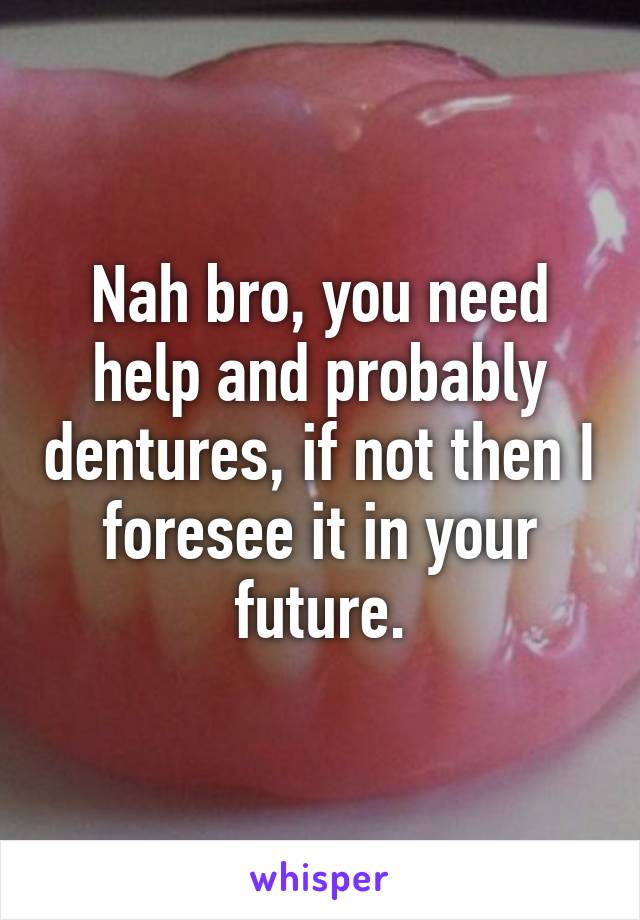 Nah bro, you need help and probably dentures, if not then I foresee it in your future.