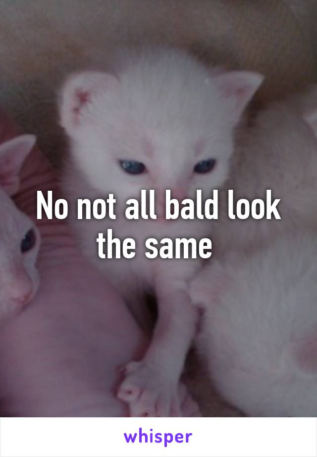 No not all bald look the same 