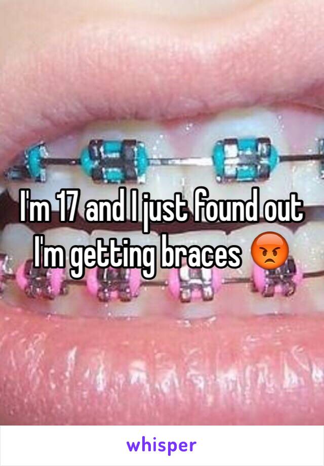 I'm 17 and I just found out I'm getting braces 😡