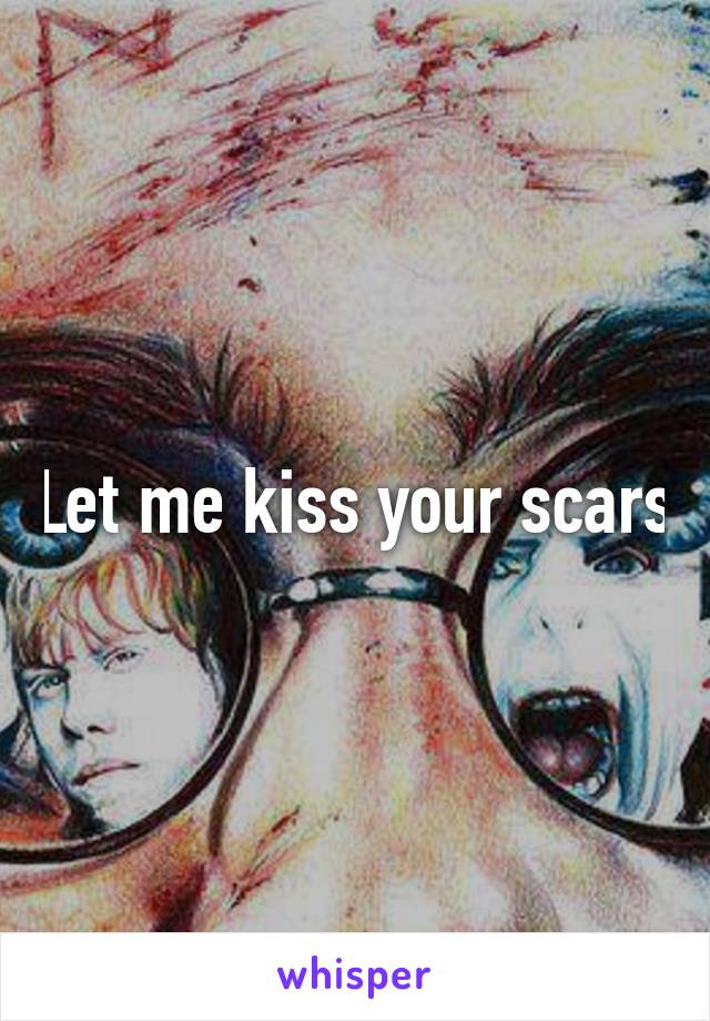 Let me kiss your scars