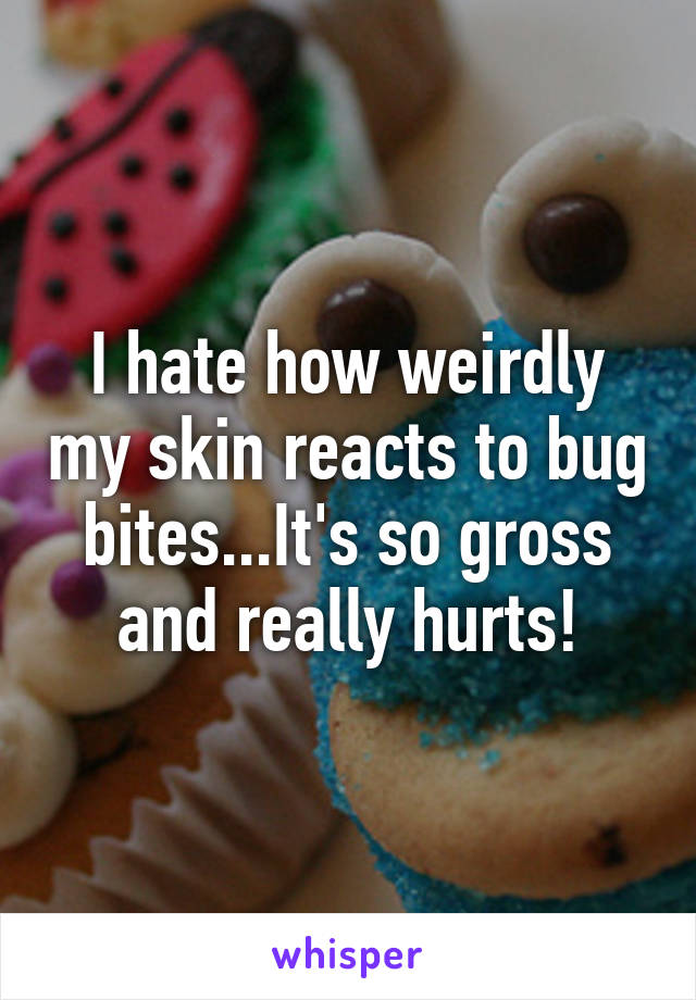 I hate how weirdly my skin reacts to bug bites...It's so gross and really hurts!