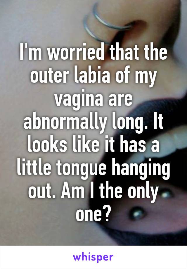 I'm worried that the outer labia of my vagina are abnormally long. It looks like it has a little tongue hanging out. Am I the only one?