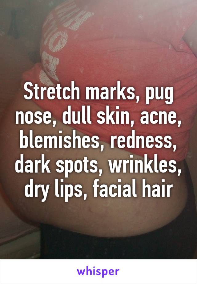 Stretch marks, pug nose, dull skin, acne, blemishes, redness, dark spots, wrinkles, dry lips, facial hair