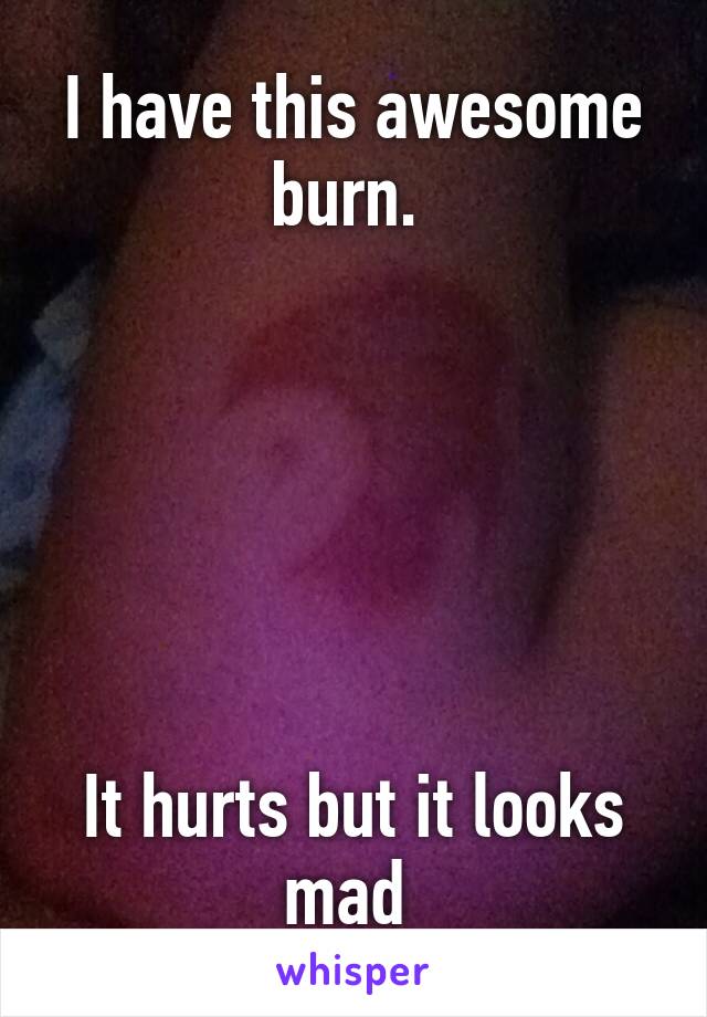 I have this awesome burn. 






It hurts but it looks mad 