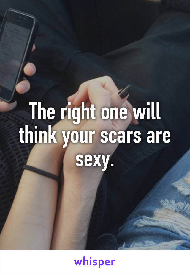The right one will think your scars are sexy.