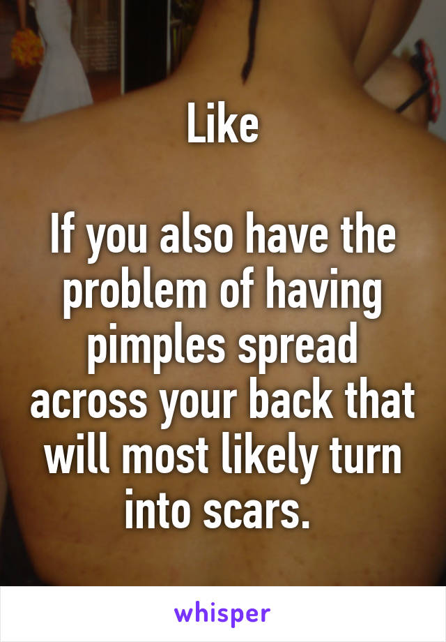 Like

If you also have the problem of having pimples spread across your back that will most likely turn into scars. 