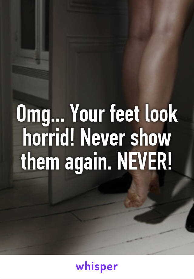Omg... Your feet look horrid! Never show them again. NEVER!