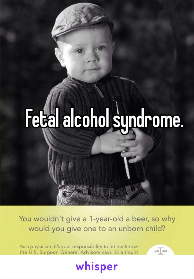 Fetal alcohol syndrome. 