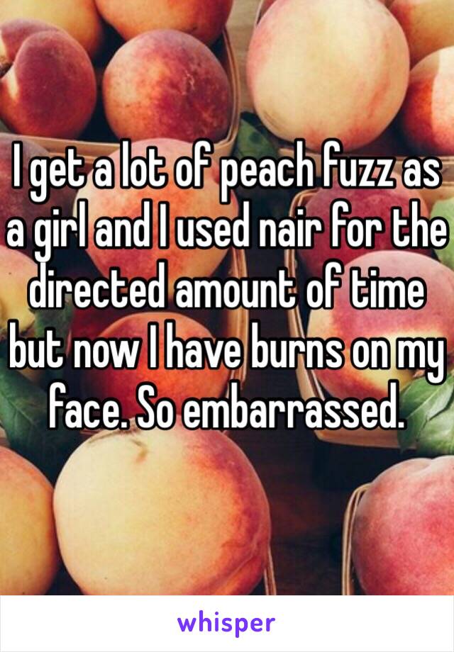 I get a lot of peach fuzz as a girl and I used nair for the directed amount of time but now I have burns on my face. So embarrassed. 