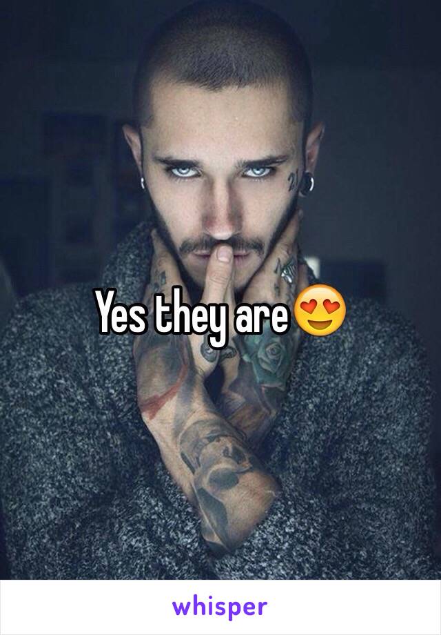 Yes they are😍