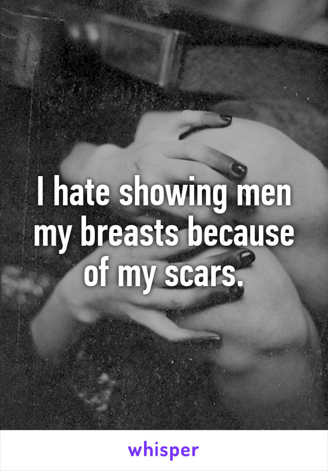 I hate showing men my breasts because of my scars.