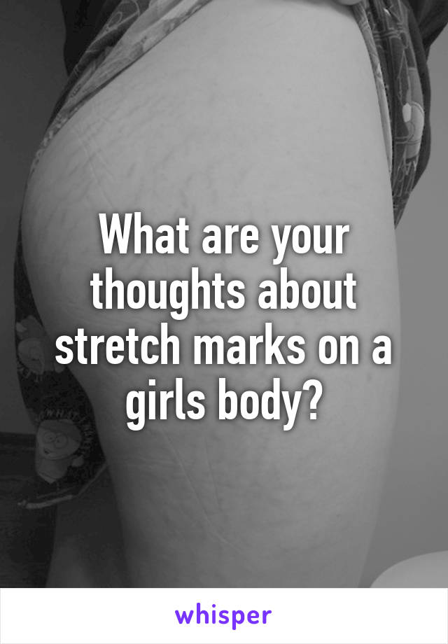 What are your thoughts about stretch marks on a girls body?