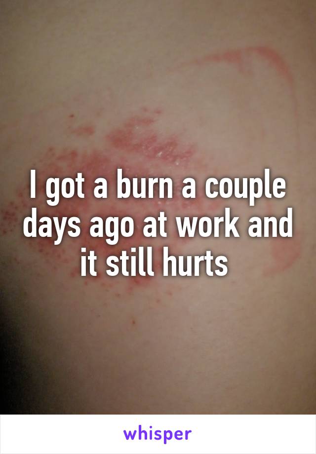 I got a burn a couple days ago at work and it still hurts 