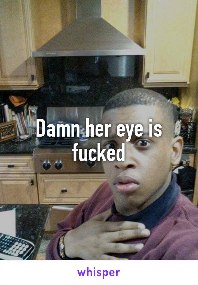 Damn her eye is fucked