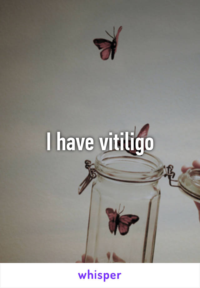 I have vitiligo