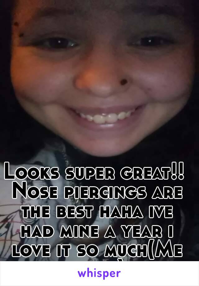 Looks super great!! Nose piercings are the best haha ive had mine a year i love it so much(Me in pic)