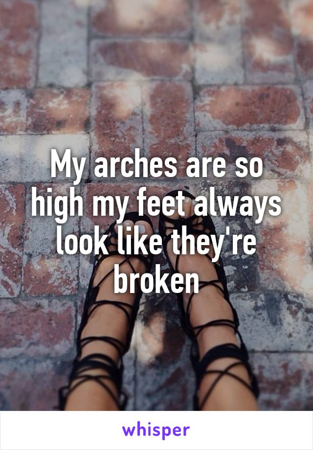 My arches are so high my feet always look like they're broken