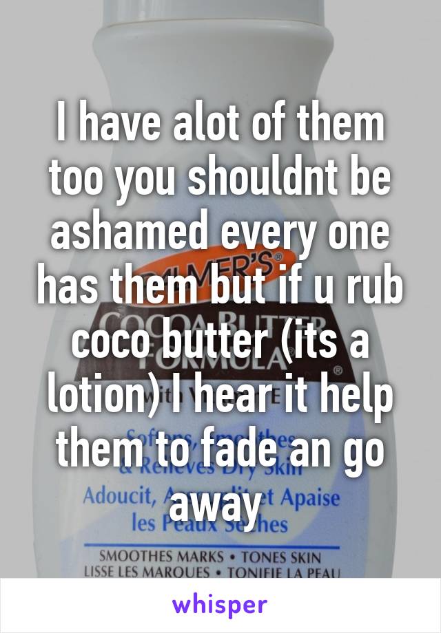 I have alot of them too you shouldnt be ashamed every one has them but if u rub coco butter (its a lotion) I hear it help them to fade an go away 