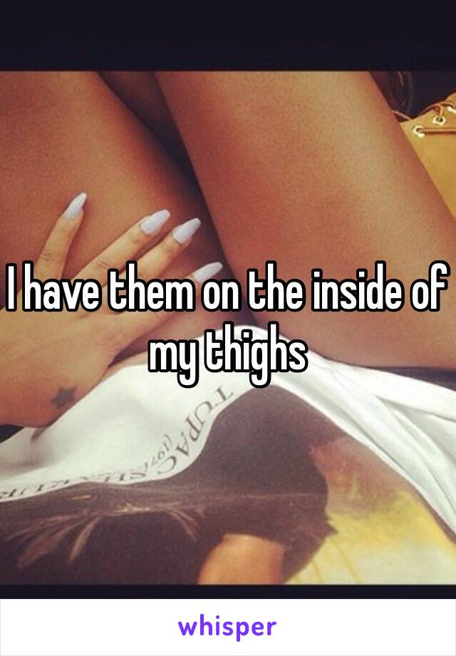 I have them on the inside of my thighs