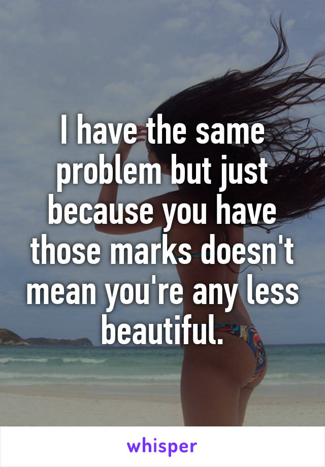 I have the same problem but just because you have those marks doesn't mean you're any less beautiful.