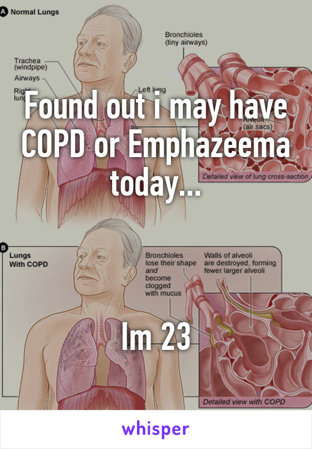 Found out i may have COPD or Emphazeema today...



Im 23