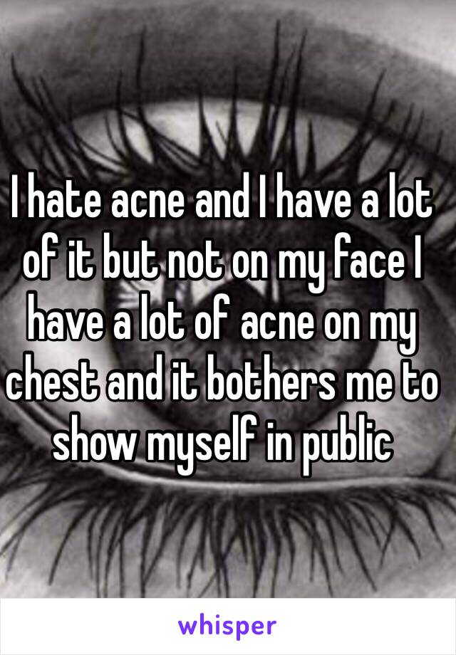 I hate acne and I have a lot of it but not on my face I have a lot of acne on my chest and it bothers me to show myself in public