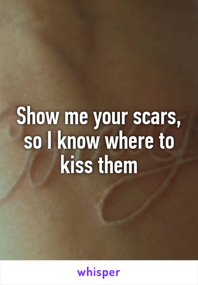 Show me your scars, so I know where to kiss them