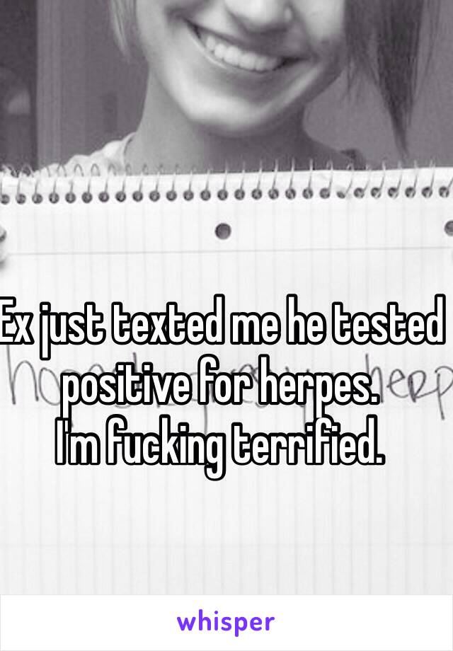 Ex just texted me he tested positive for herpes. 
I'm fucking terrified.