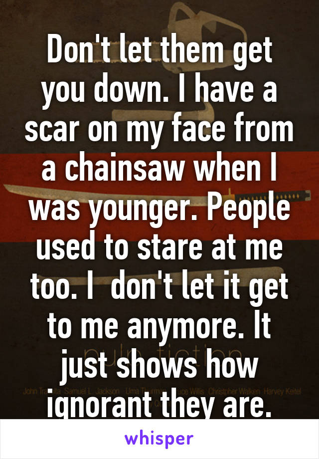 Don't let them get you down. I have a scar on my face from a chainsaw when I was younger. People used to stare at me too. I  don't let it get to me anymore. It just shows how ignorant they are.