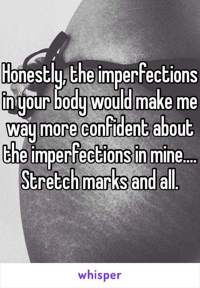 Honestly, the imperfections in your body would make me way more confident about the imperfections in mine.... Stretch marks and all.