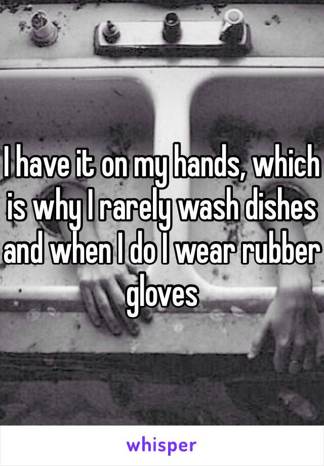 I have it on my hands, which is why I rarely wash dishes and when I do I wear rubber gloves