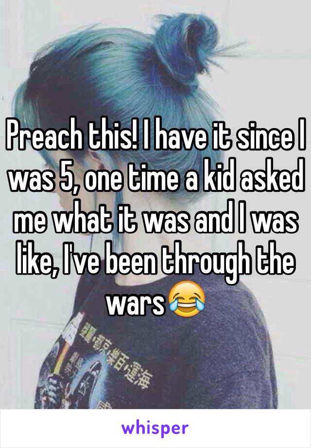 Preach this! I have it since I was 5, one time a kid asked me what it was and I was like, I've been through the wars😂