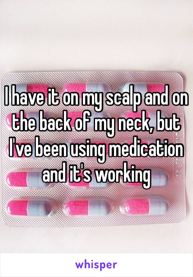 I have it on my scalp and on the back of my neck, but I've been using medication and it's working