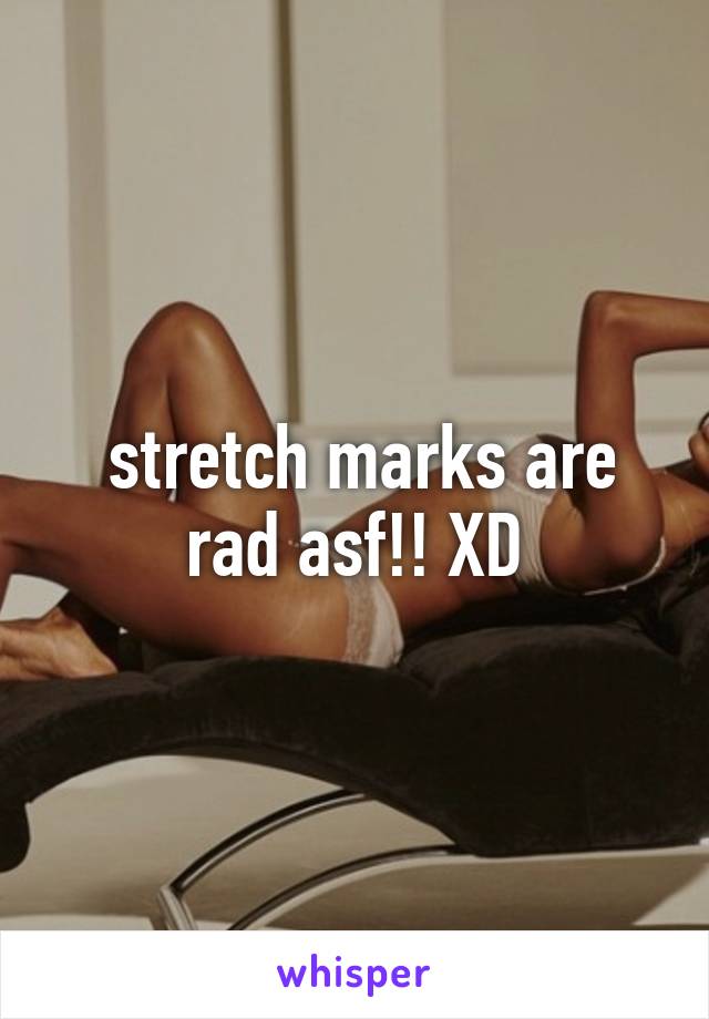  stretch marks are rad asf!! XD