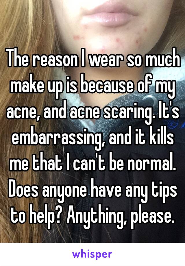 The reason I wear so much make up is because of my acne, and acne scaring. It's embarrassing, and it kills me that I can't be normal. Does anyone have any tips to help? Anything, please.